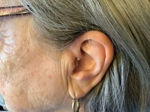 Françoise D., 72 ans